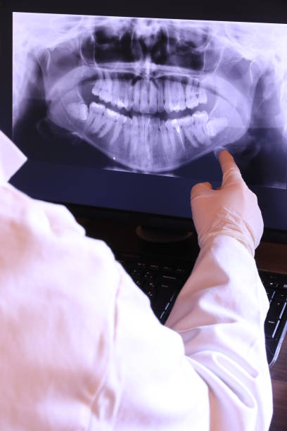 Best Emergency Tooth Extraction in Warrenton, GA